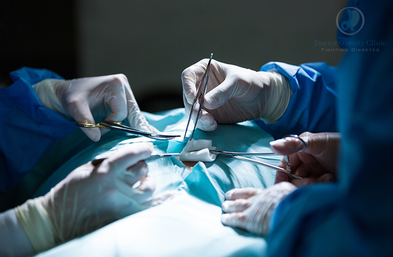 bariatric surgery in karachi